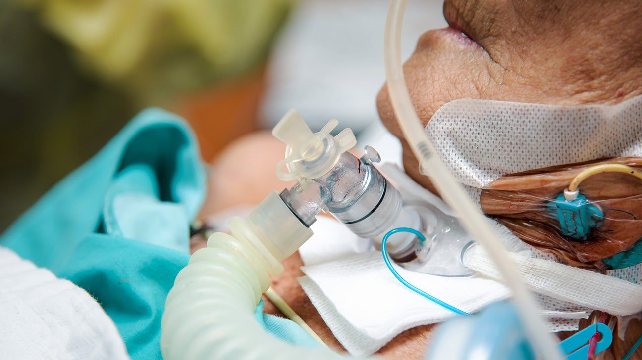 Ventilatöre bağlı yaşlı hasta yakından görüntü.